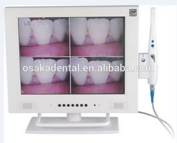 Caméra intra-orale dentaire à écran de 15 pouces avec Wi-Fi