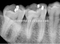 Mur dentaire monté avec la machine à rayons X approuvée CE