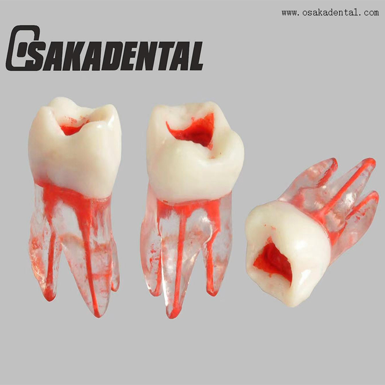 Modèle de dent de train de canal radiculaire endodontique dentaire