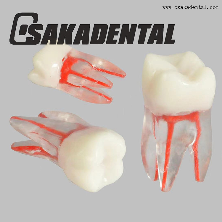 Modèle de dent de train de canal radiculaire endodontique dentaire